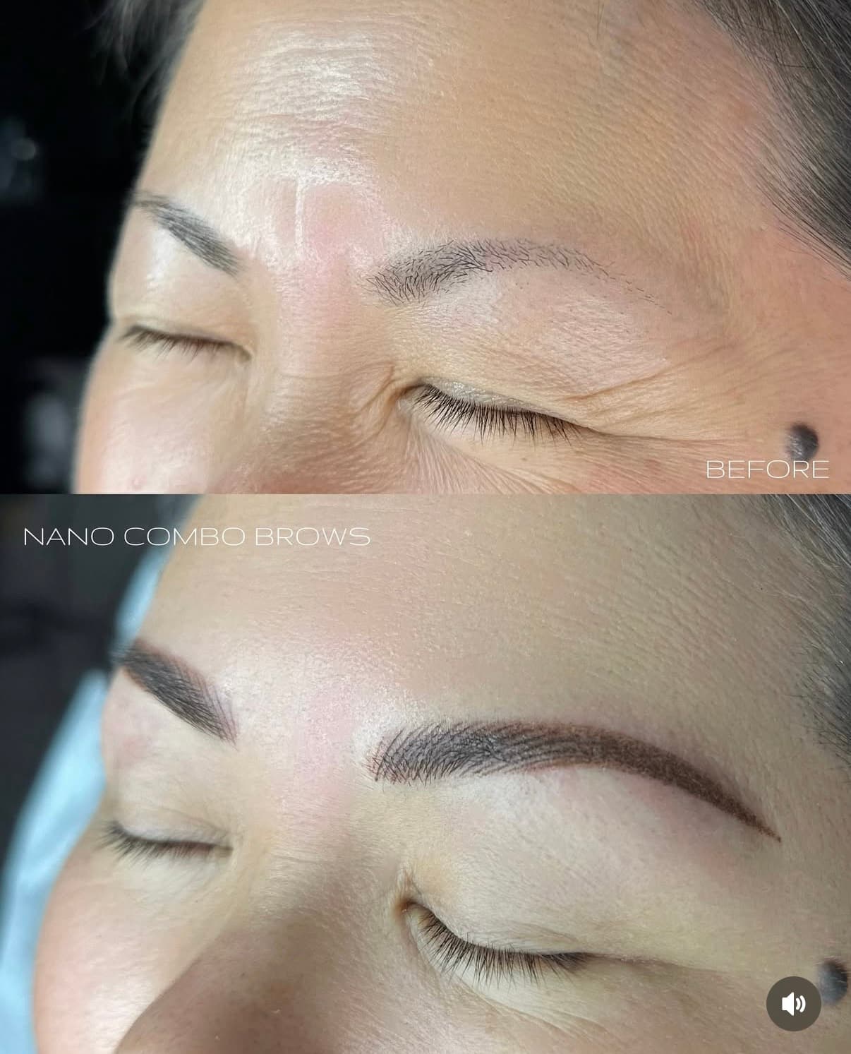 Brow result