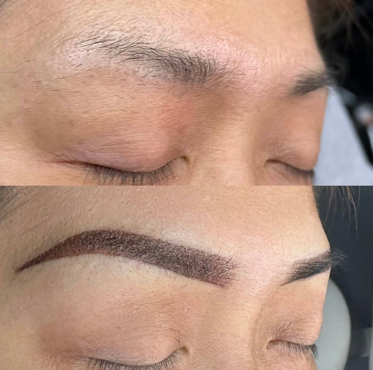 Brow result
