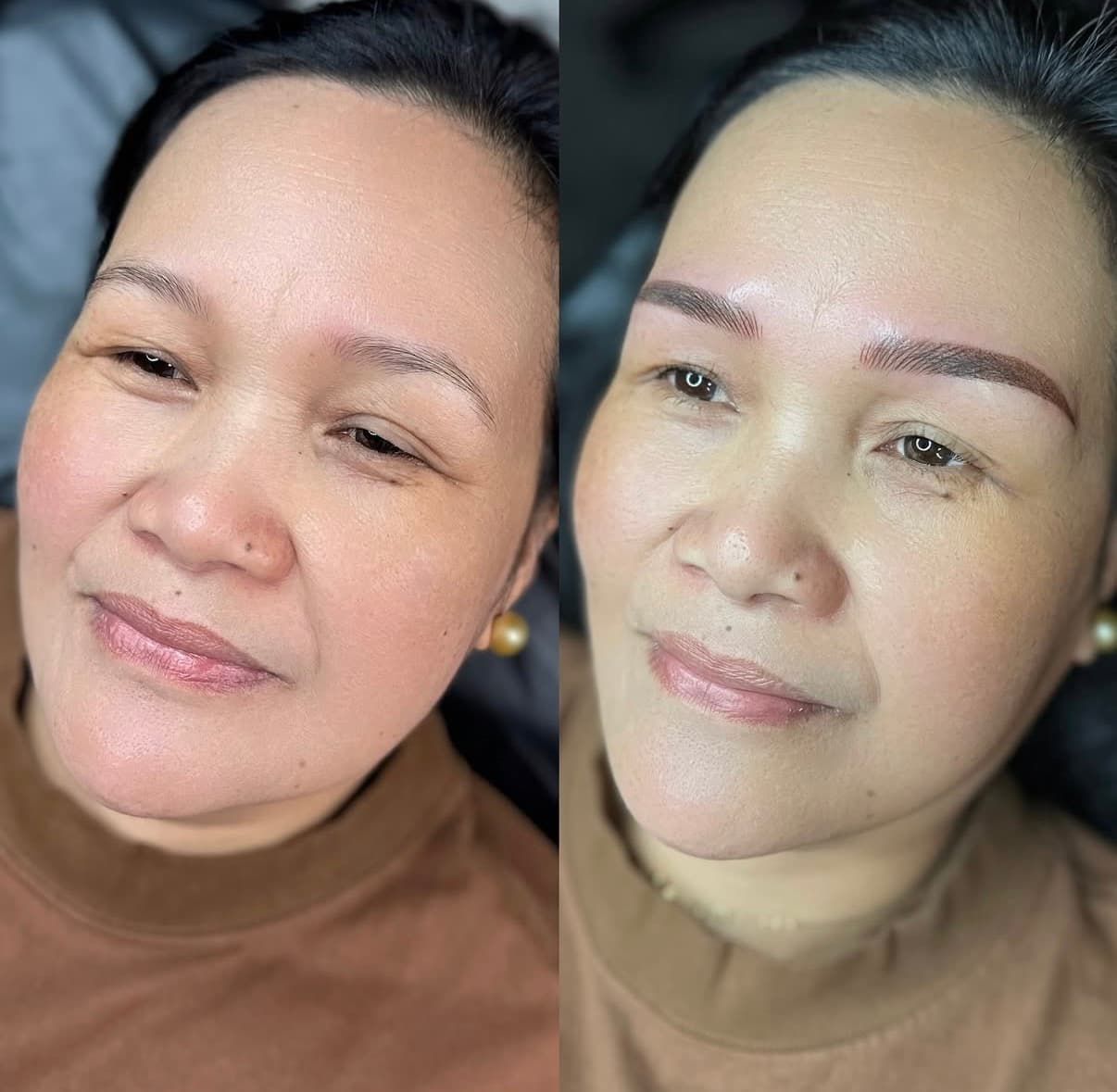 Brow result